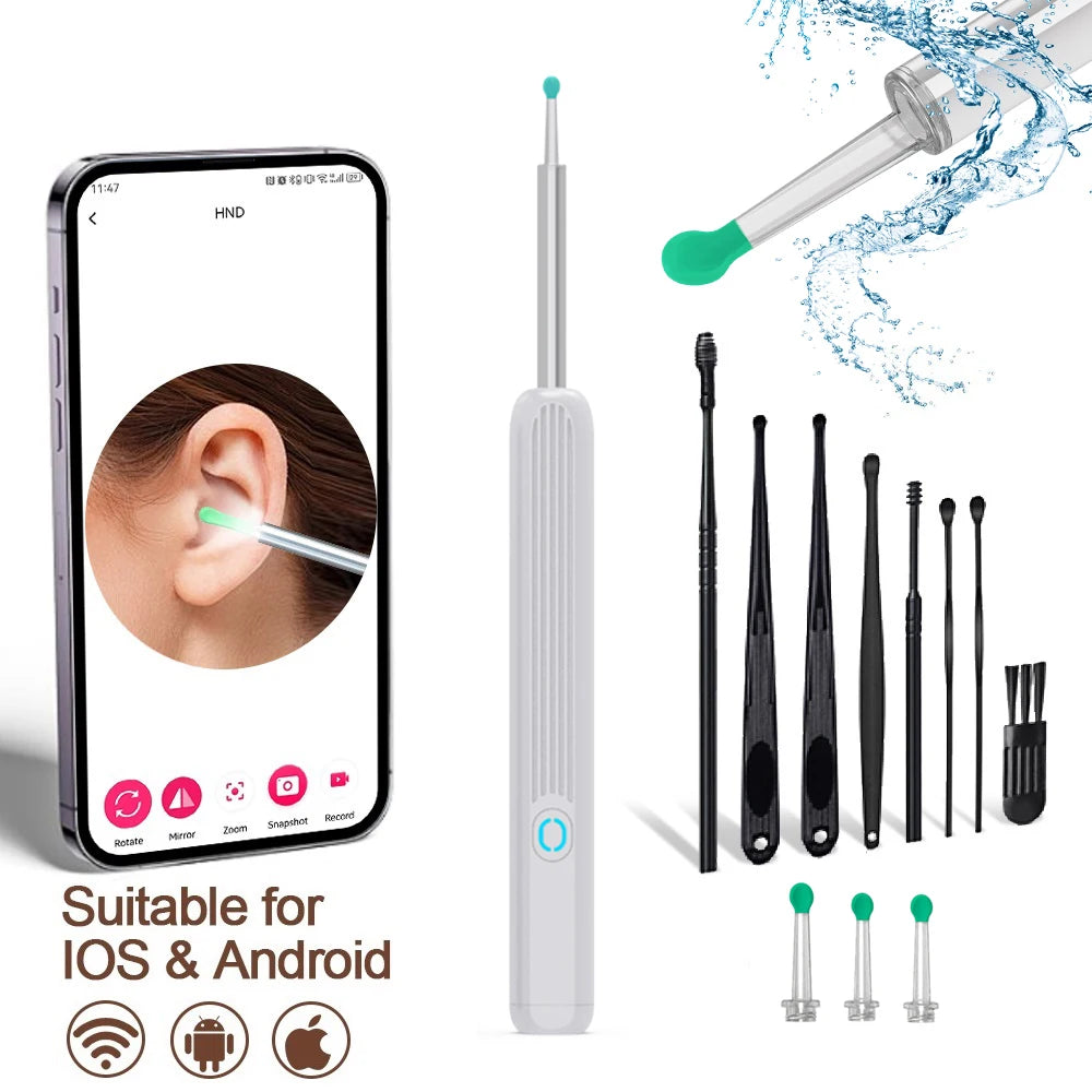 Ear Cleaner With Camera | Orocam™